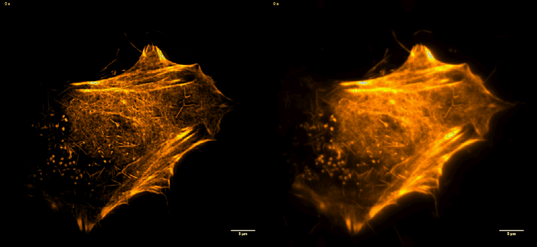 TIRFSIM-TIRF Comparison HeLa cells