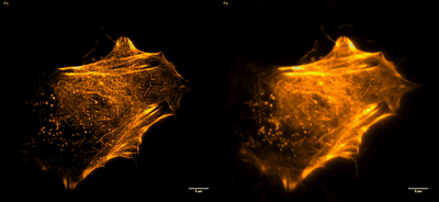 TIRFSIM-TIRF Comparison HeLa cells