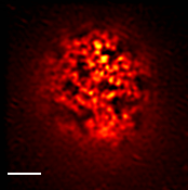 PvO-yeast-Sag1 - TIRF-SIM.png