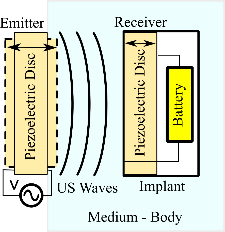 Ultrasonic transducer